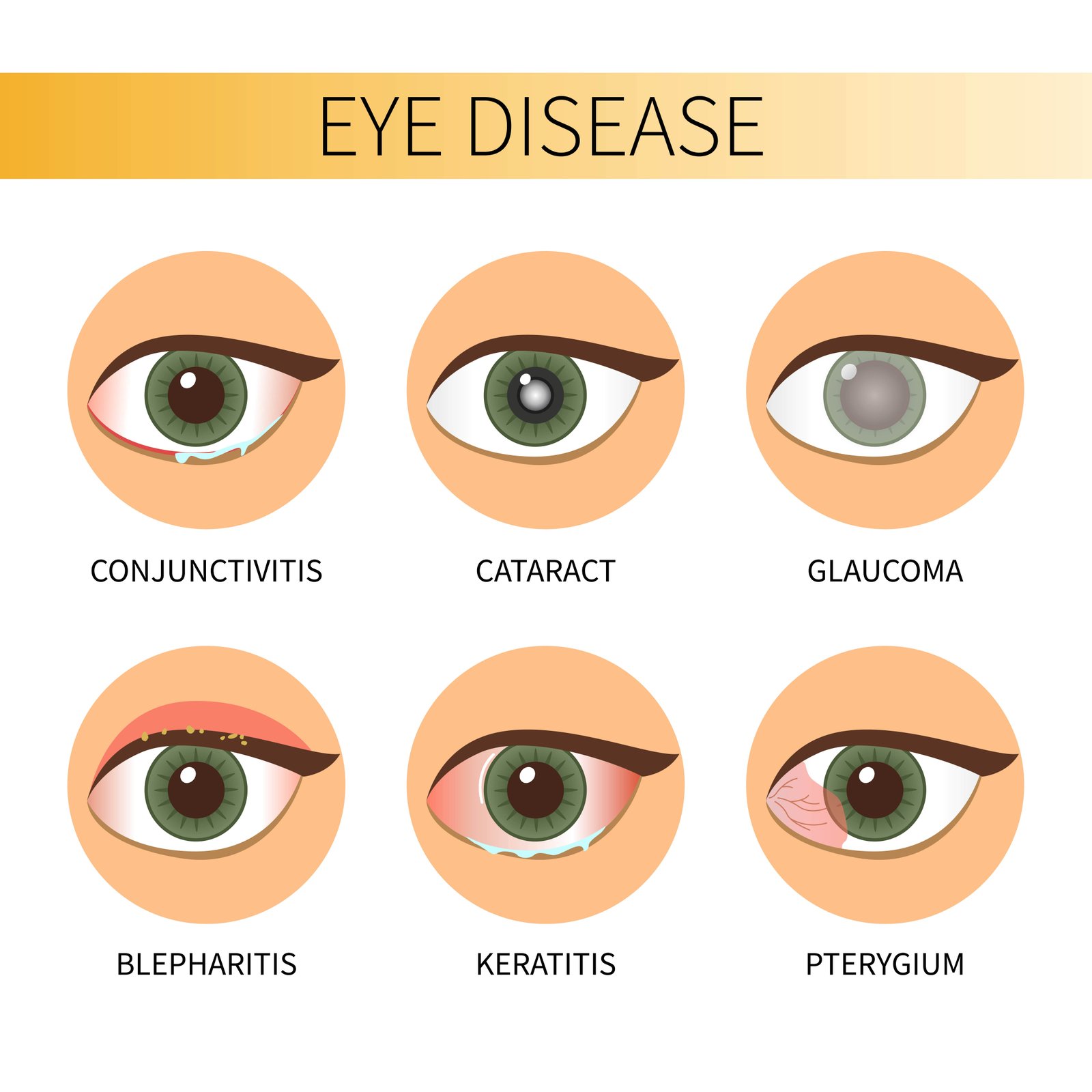 eye checks